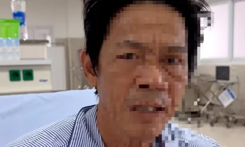 Lý do giúp người đàn ông bị nhồi máu não thoát chết "thần kỳ"